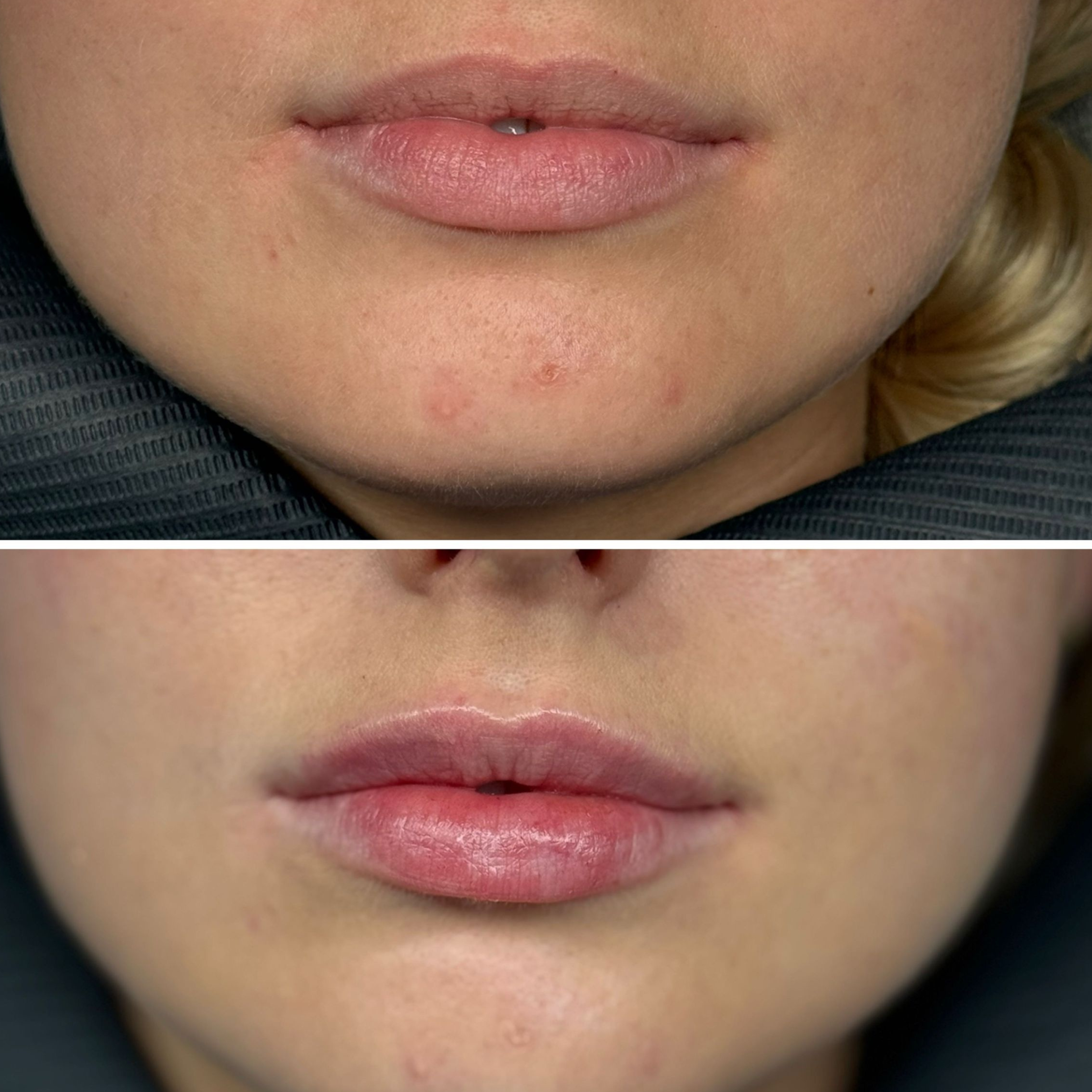 Efekty zabiegów Marsi Beauty przed i po