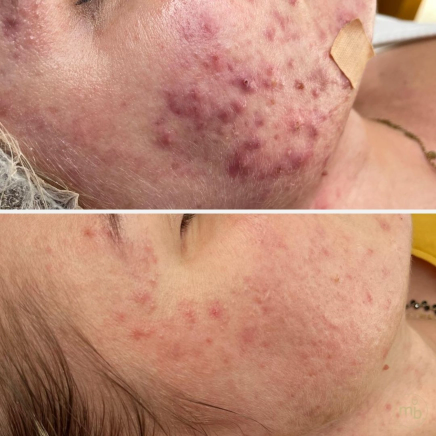 Efekty kosmetologii estetycznej Marsi Beauty