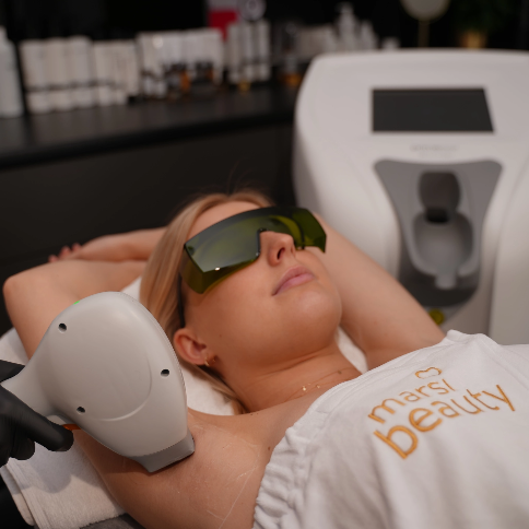 Depilacja laserowa Marsi Beauty