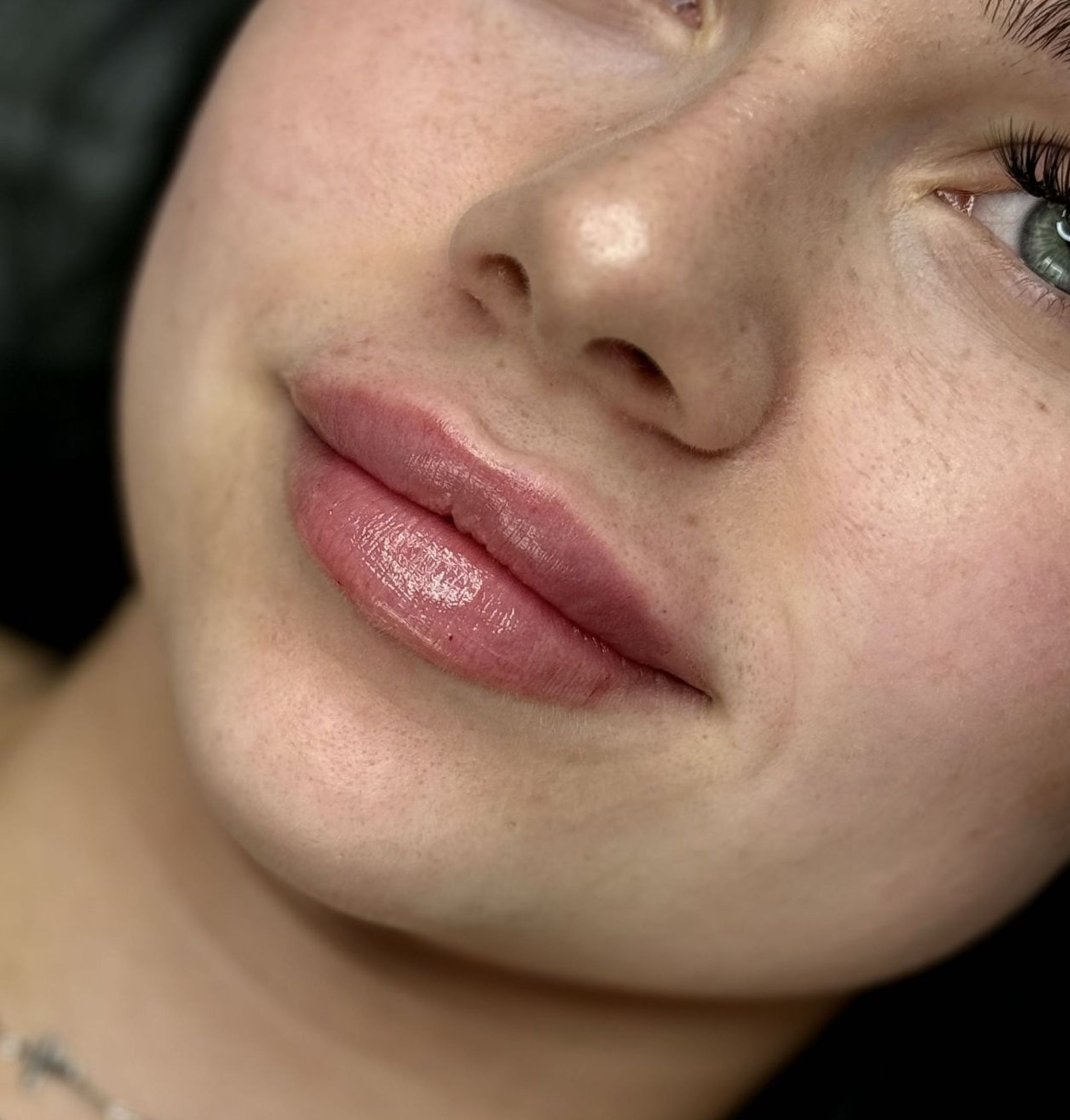 Efekty zabiegów Marsi Beauty przed i po