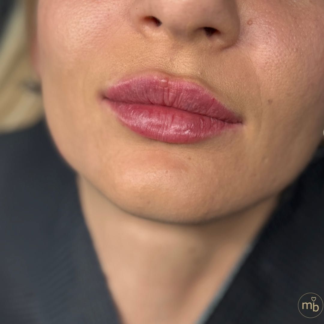 Efekty kosmetologii estetycznej Marsi Beauty
